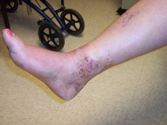 Inside of ankle Inside of ankle